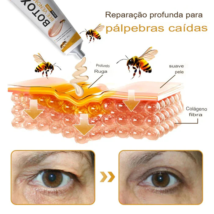 Botox BeeVenom - Creme Remoção de Rugas ( COMPRE 1 LEVE 2 )