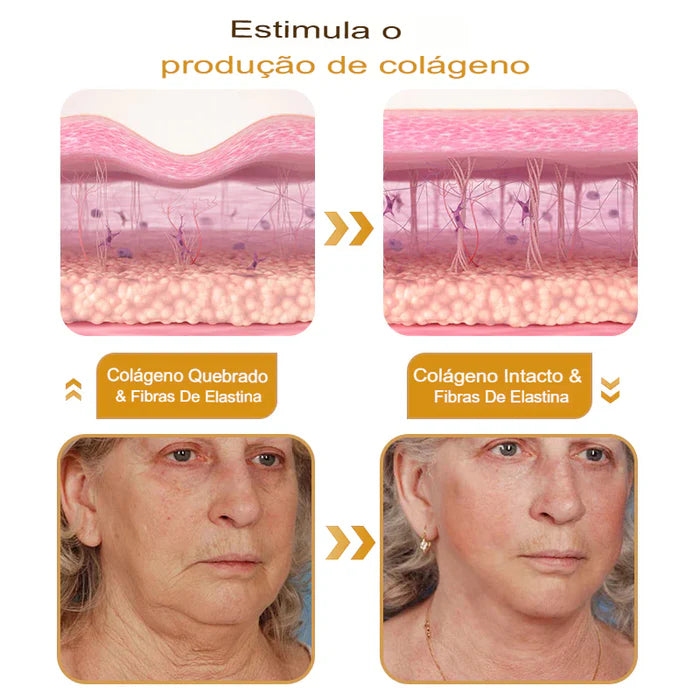 Botox BeeVenom - Creme Remoção de Rugas ( COMPRE 1 LEVE 2 )